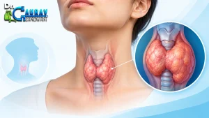 Minimally invasive treatment by Dr. Gaurav Gangwani using image-guided technique"