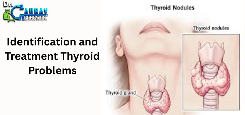 Identification and Treatment Thyroid Problems