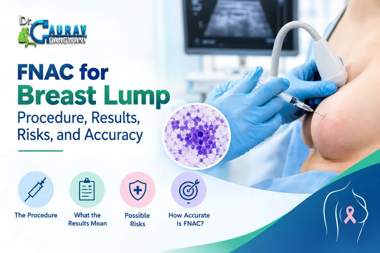 FNAC for Breast Lump